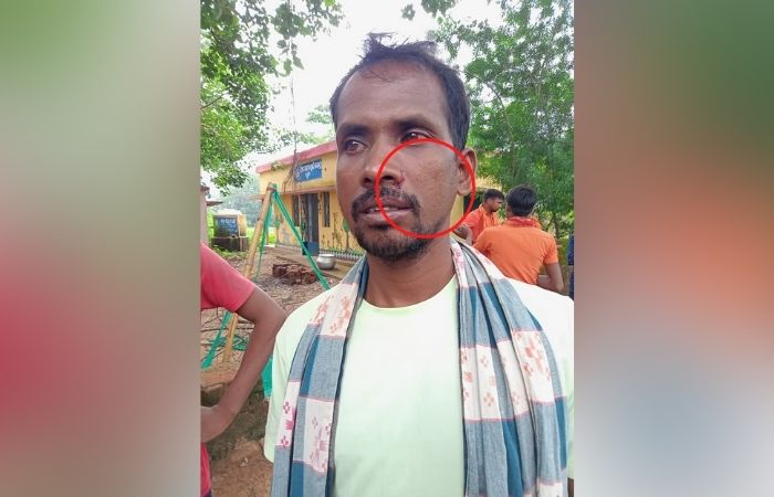 Bolangir Teacher Beats Local