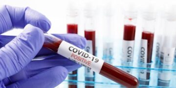 Clay-based COVID-19 detection