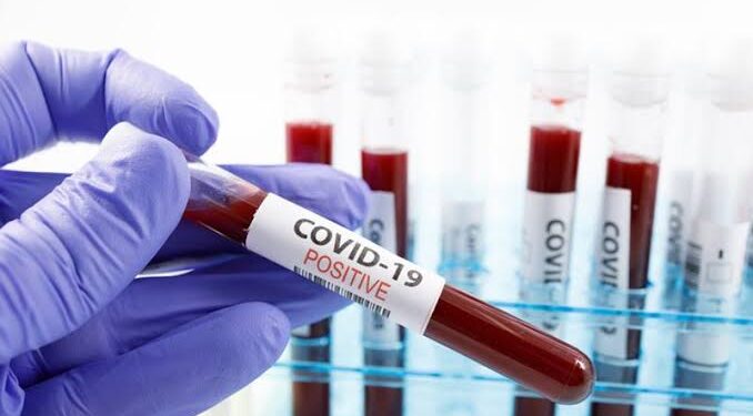 Clay-based COVID-19 detection