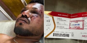 Lone survivor Air India Flight 171