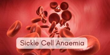 Sickle cell