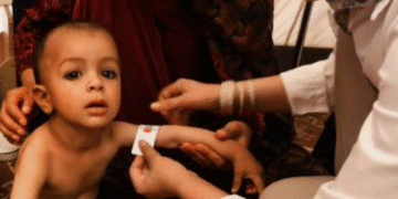 Severe Acute Malnutrition in Odisha