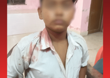 Student Brutally Beaten Up