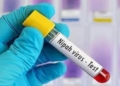 Nipah virus