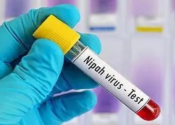 Nipah virus