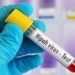 Nipah virus