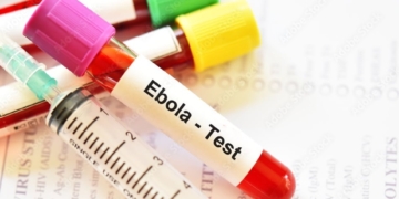 Ebola