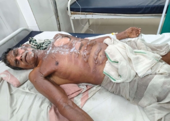 Boiling oil attack