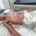Boiling oil attack