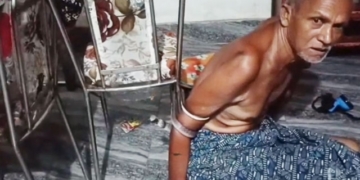 Snake Wraps Paralysed Man’s Hand