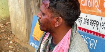 PEO Assaults Sarpanch