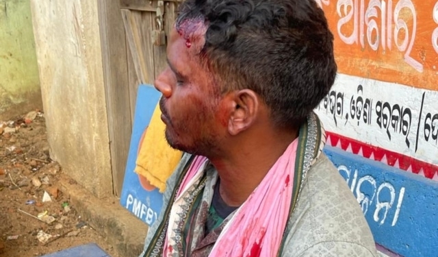 PEO Assaults Sarpanch