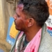 PEO Assaults Sarpanch