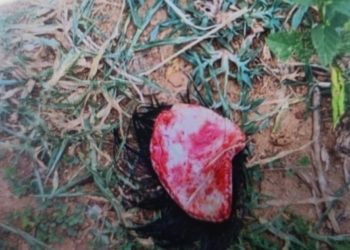 dog attack in Ganjam