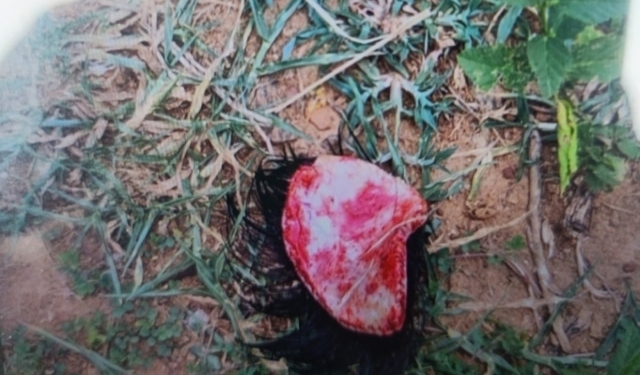 dog attack in Ganjam