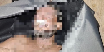 Body Recovered from Puri’s Narendra Pond, Police Begins Probe
