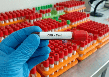 Test CPK-MB for Heart Attack Diagnosis: How It Works