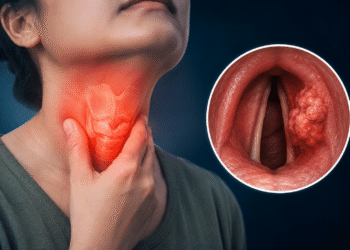 Throat Cancer Symptoms That Last More Than Two Weeks