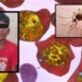 Malaria Death