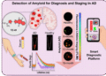 smartphone Alzheimer’s detection