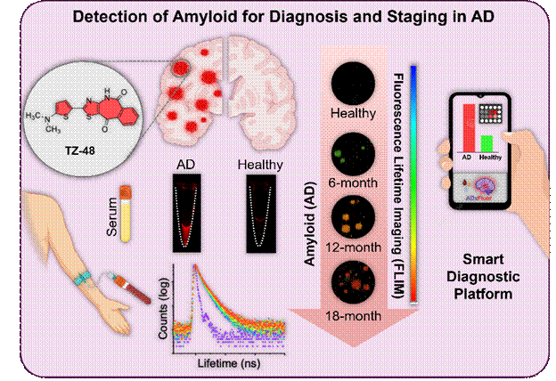 Smartphone Alzheimer’s Detection: A Game-Changer