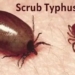 Scrub typhus cases Anugola