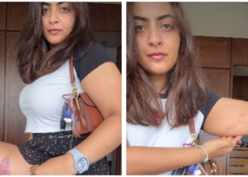 Aamir Khan's Niece Zayn Marie Shows Injury Marks After Mumbai Police Detention During CJP Protest