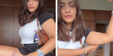 Aamir Khan's Niece Zayn Marie Shows Injury Marks After Mumbai Police Detention During CJP Protest