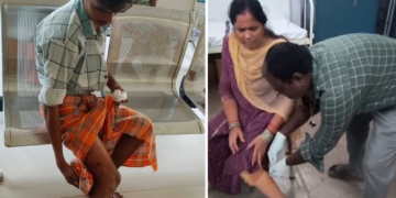 Rayagada stray dog attack